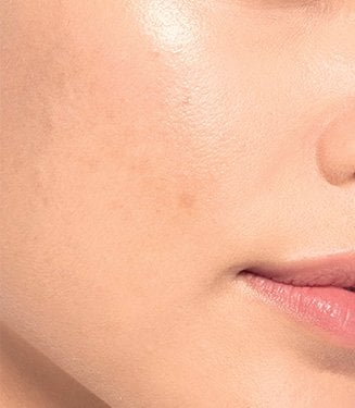 سيروم تفتيح البشرة الفوري - Glycolic Bright من لوريال باريس