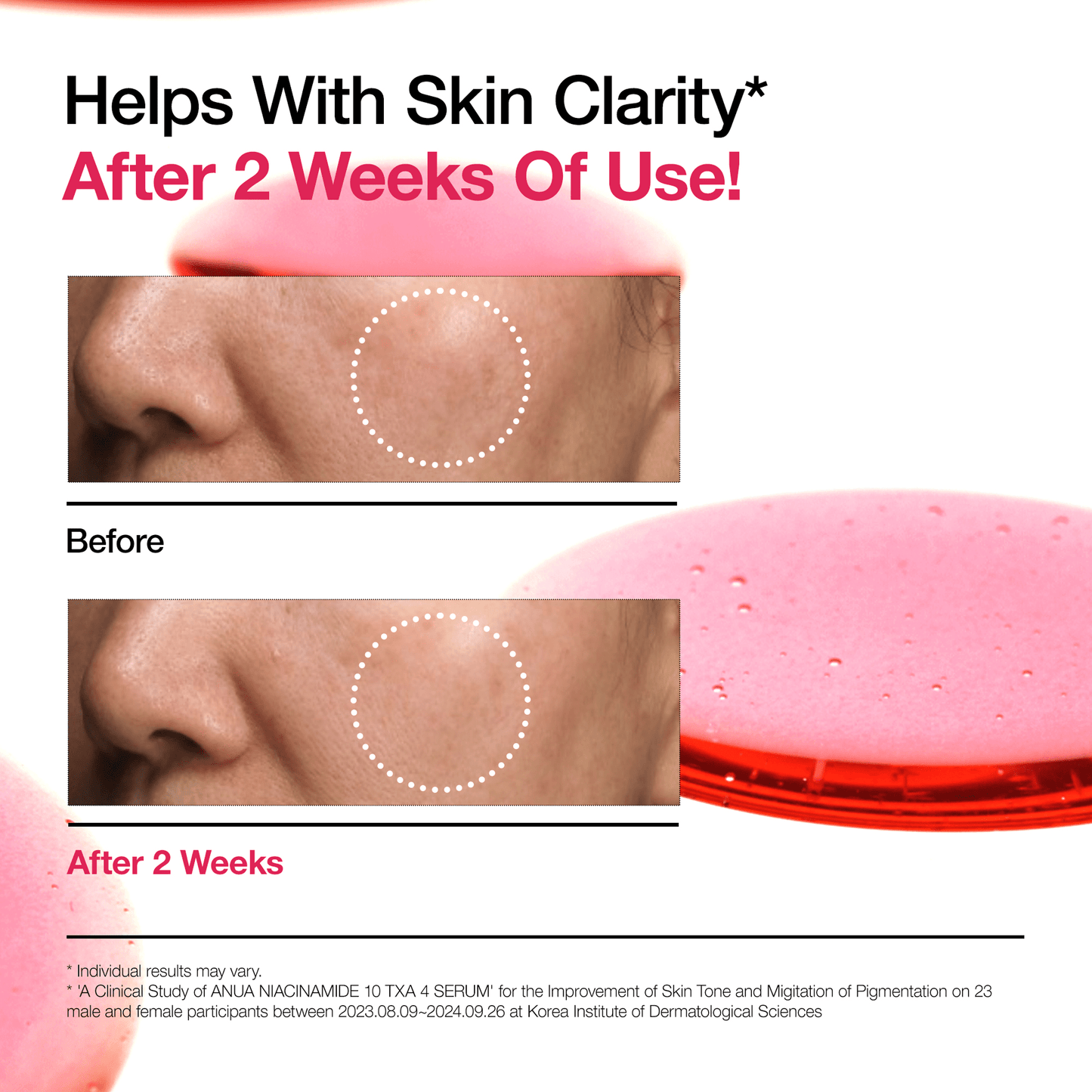 Anua Niacinamide 10% + TXA 4 Serum